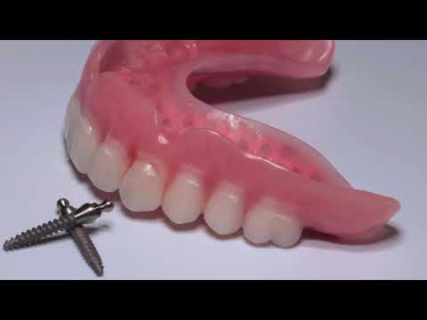 Video: Ako nosiť zubné protézy