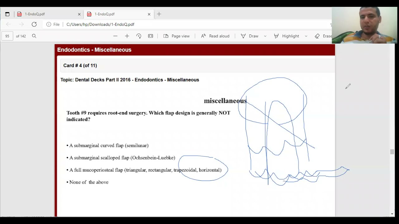 هو ازاي الاندو ممكن يكون سهل كده 🤔🤔🤔🤔الدنتل ديكس #السعوديه#برومترك#اسنان