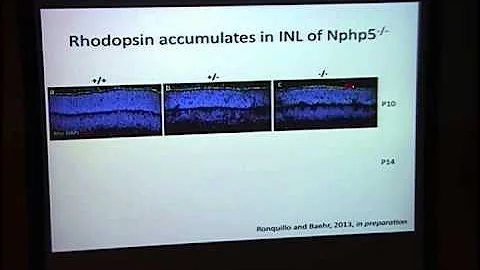 Senior-Loken Syndrome:  From Human Genetics to an ...