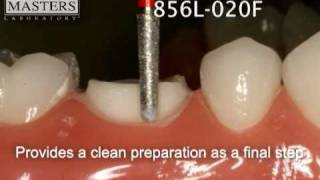 Perfect Prep Bur Kit for e.max CAD by Dental Masters Laboratory