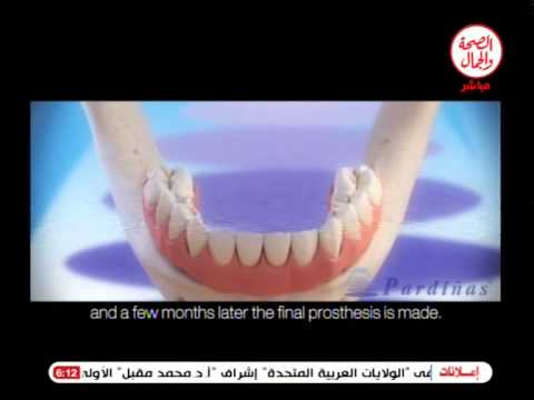 زراعة الأسنان مع دكتور محمد السيد