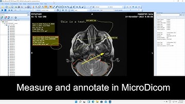 How to Measure and Annotate DICOM Images in MicroDicom | DICOM Viewer Tutorial