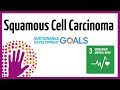 Sun And Squamous Cell Carcinoma Of The Skin