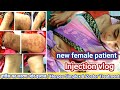 हर्पीस का कारण ओर इलाज / Herpes Simplex &amp; Zoster Treatment In Hindi #newgirlinjection #injection 