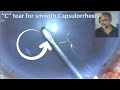 The c tear for smooth capsulorrhexis
