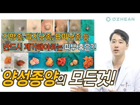 양성종양(혹, 종기, 지방종, 피지낭종, 표피낭, 모낭종) 제거에 대하여 단 한번에 정리해드립니다!  [성형 알려주는 남자 이용석]