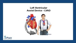 Left Ventricular Ist Device - Lvad