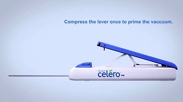Celero Breast Biopsy: Device Instruction Animation