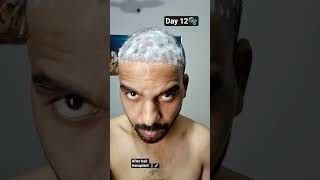 fast head wash day 12  #explorepage #hairtransplant #haircare #trending #ytshorts #shorts