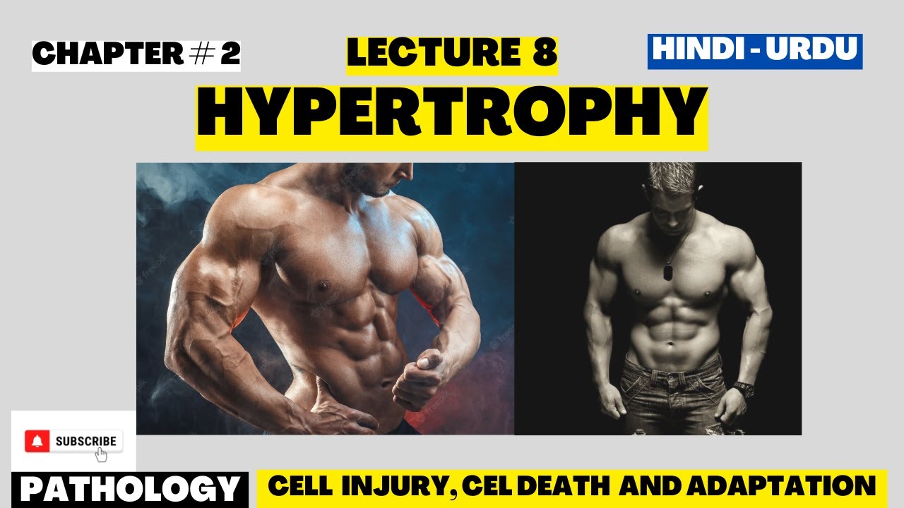 Hypertrophy Types of Hypertrophy Cell injury, Cell Death and