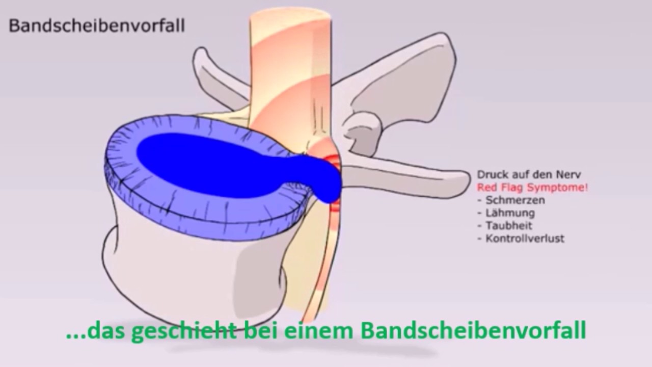 Biotechnologisches Nucleus Implantat RIZ GENIUS 2017