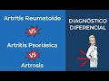 Artritis Reumatoide vs Artritis Psoriásica vs Artrosis. Diagnóstico diferencial