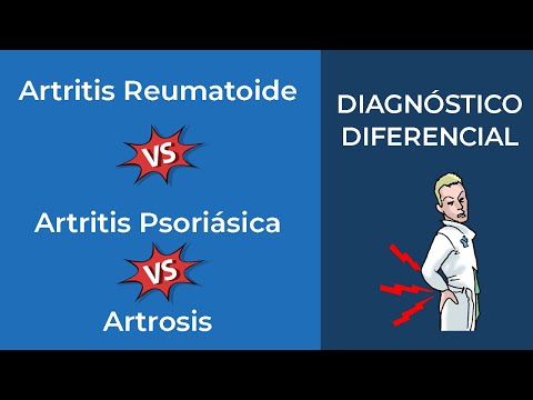 Vídeo: Artritis Psoriásica: Tipos, Síntomas, Diagnóstico Y Más