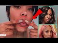 K.Michelle shares that she has fillers in her face