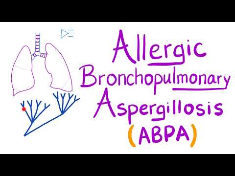 Video: Allergisk Bronchopulmonal Aspergillose: Årsager Og Diagnose