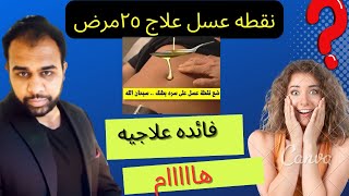 نقطه عسل علي السره كفيله بعلاج ٢٥مرض مزمن الطب البديل الأعشاب الطبيعيه امجد سامي