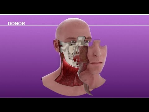 Video: Hoe werk rekonstruktiewe chirurgie?