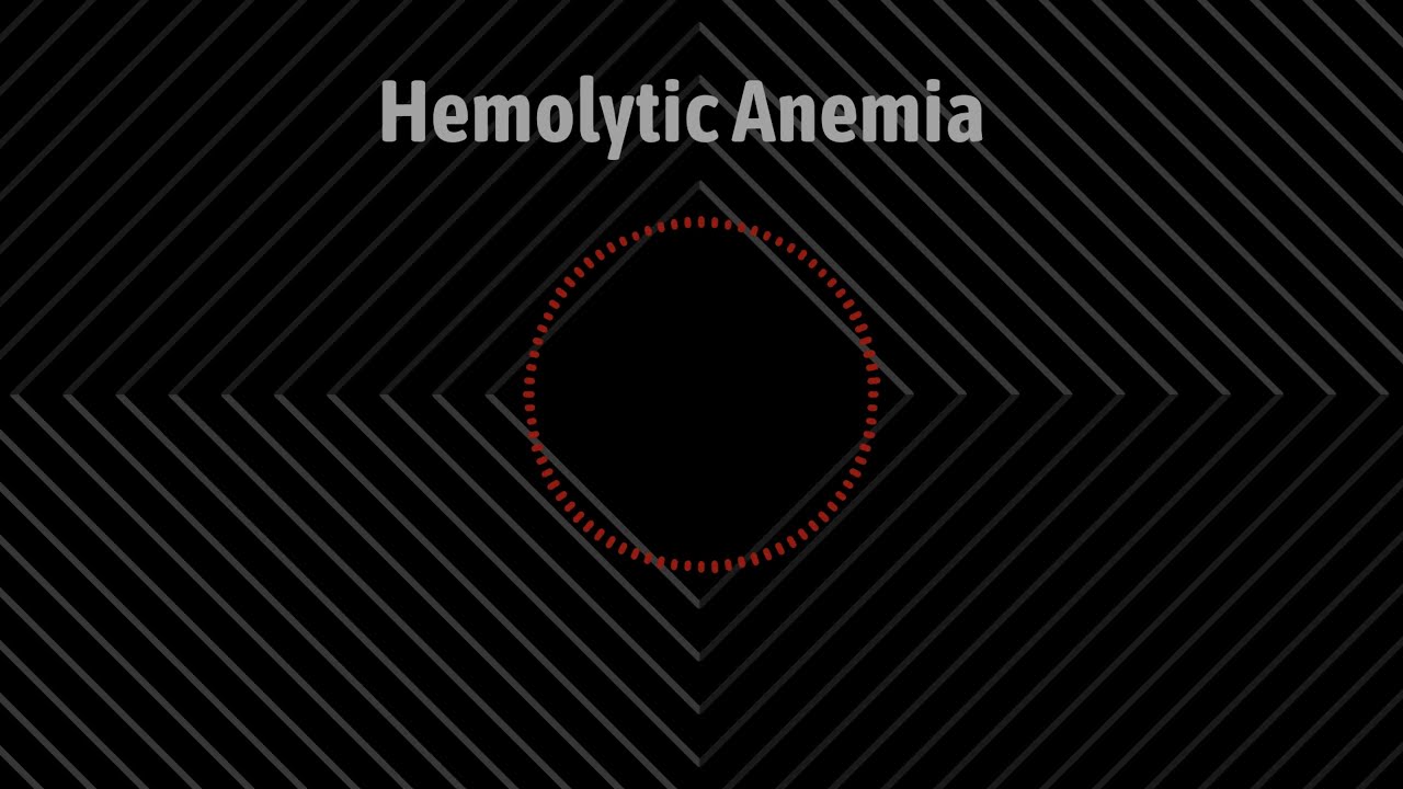 Watch Dr Tony & Shak - Hemolytic Anemia (Lyrics) on YouTube Watch Dr Tony & Shak - Hemolytic Anemia (Lyrics) on YouTube