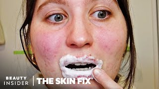 Foaming Lip Scrub Under A Microscope | The Skin Fix