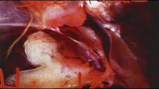 Sasoi Ilunak - Ankerra