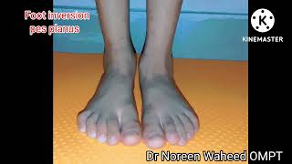 what is flat feet/ complications in flat feet children/how to check it