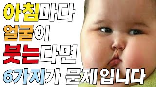 얼굴 붓기 빼는법/ 아침마다 얼굴이 붓는 6가지 이유/ 얼굴 부종 없애기