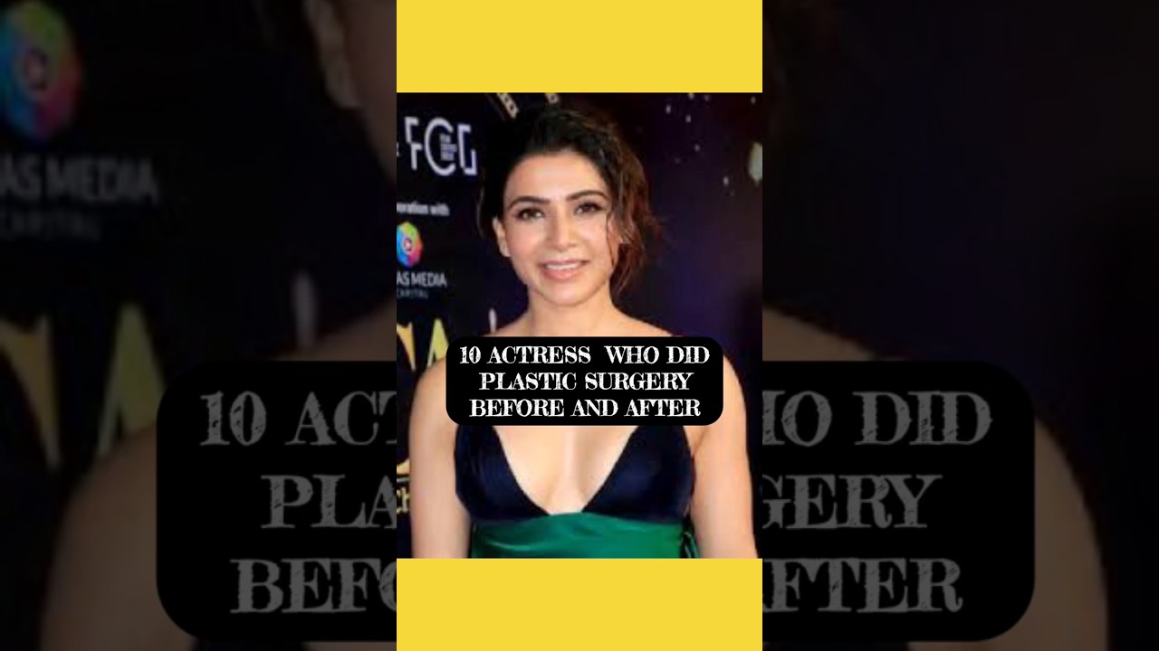 10 actresses who did plastic surgery #music