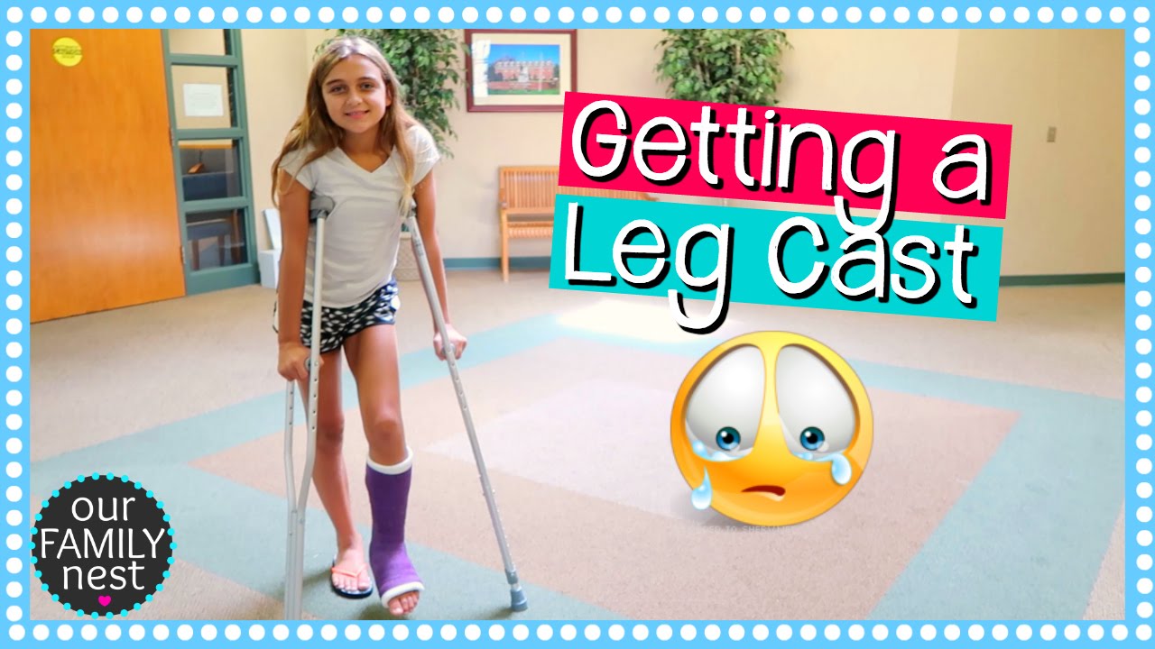 GETTING A LEG CAST FOR BROKEN FOOT | DANCE INJURY - YouTube
