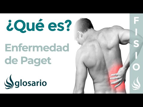 Vídeo: Síndrome De Paget-Schrötter: Causas, Síntomas Y Tratamiento