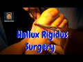 Hallux Rigidus Surgery Without Fusion or Joint Replacement
