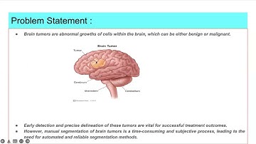 Hybrid Segmentation Approach Using Mean Shift Clustering for Enhanced MRI Brain Tumor Analysis