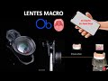 Lentes macro para celular en Odontología 📱 🔍