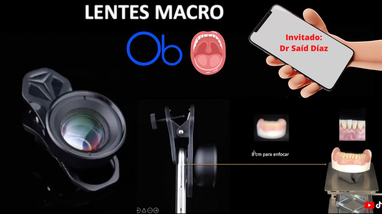 Lentes macro para celular en Odontología 📱 🔍 