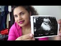 SEMANA 9 - 10 DESPUES DE UN ABORTO ESPONTÁNEO YA EL BEBE SE PUEDE VER // CÓLICOS  SANGRADO ?