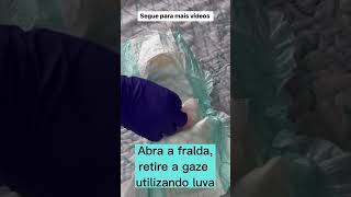 Coletar Urina Do Bebê Sem Coletor