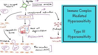 Type III Hypersensitivity – Immune Complex Mediated Hypersensitivity
