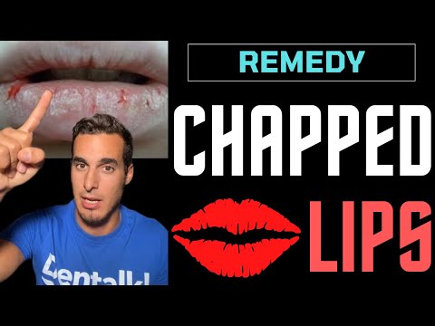 Video: Buzele crăpate ar putea fi altceva?