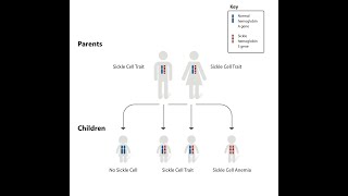Grenada's Sickle Cell Disease Connection