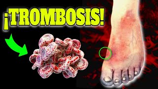 How to PREVENT a THROMBOSIS | FOODS that IMPROVE BLOOD CIRCULATION