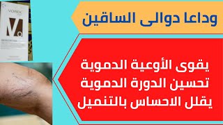 علاج دوالى الساقين بدون جراحه فى ٣اسابيع.افضل كريم لعلاج الدوالي