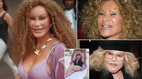Catwoman’ Jocelyn Wildenstein Dies at 84: A Life of Glamour and Transformation
