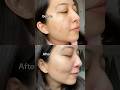 Dr. Althea 345 relief cream. Results after one month #shorts #skincarereview #koreanskincare