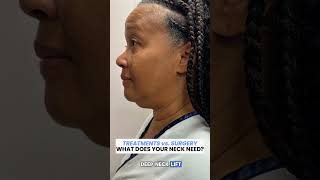 Neck Treatments Vs. Neck Lift What Does Your Neck Actually Need?