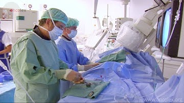 Hepatic artery embolisation