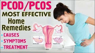Natural Treatment For PCOS | Effective Home Remedies PCOS | Women Health Tips | ABC HEALTH