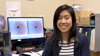Quantifying CFTR Ion Channel Function with Sweat Tests Cf Foundation What Is The Sweat Test
