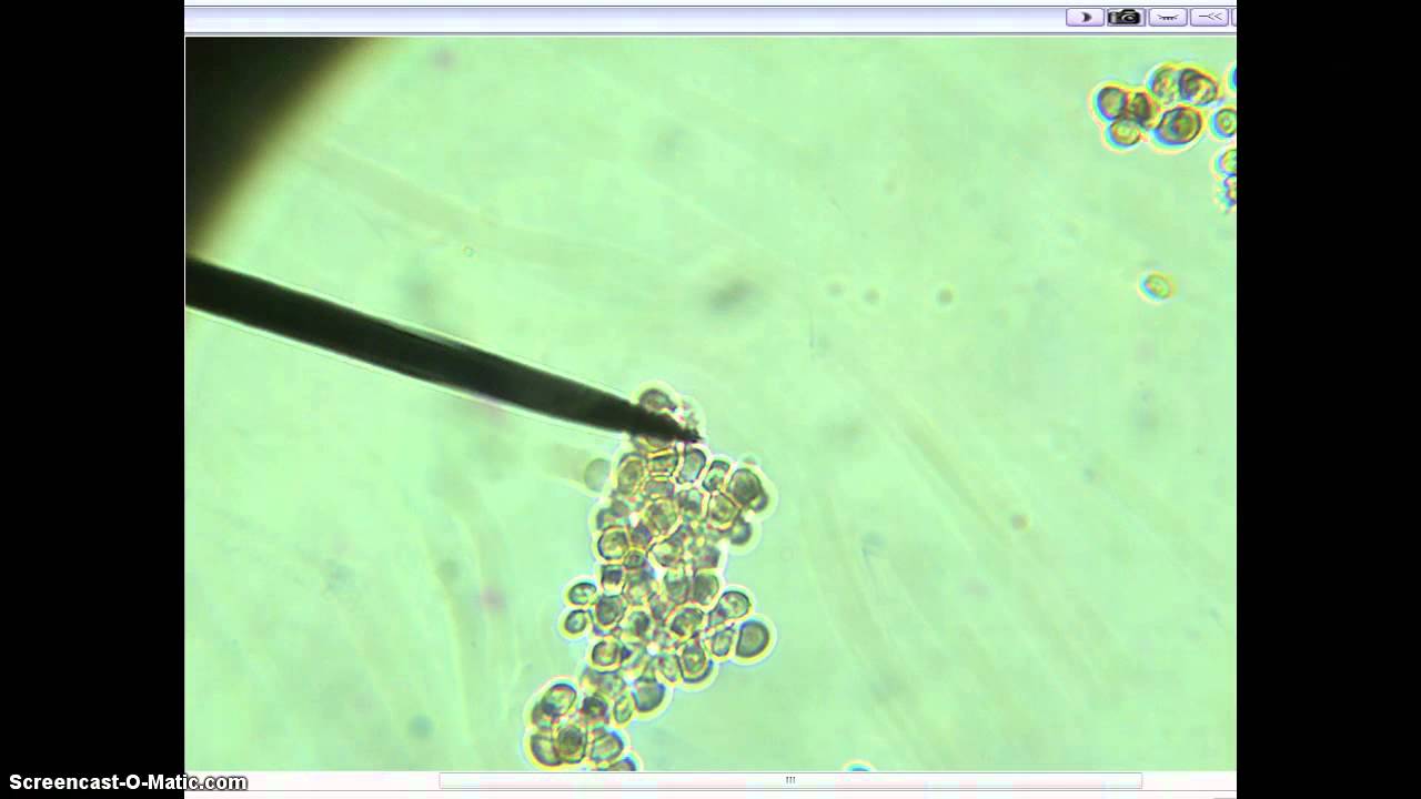 yeast active transport