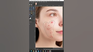 shorts// face pimpel remove in gimp