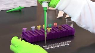 How To Perform A Quantitative Elisa
