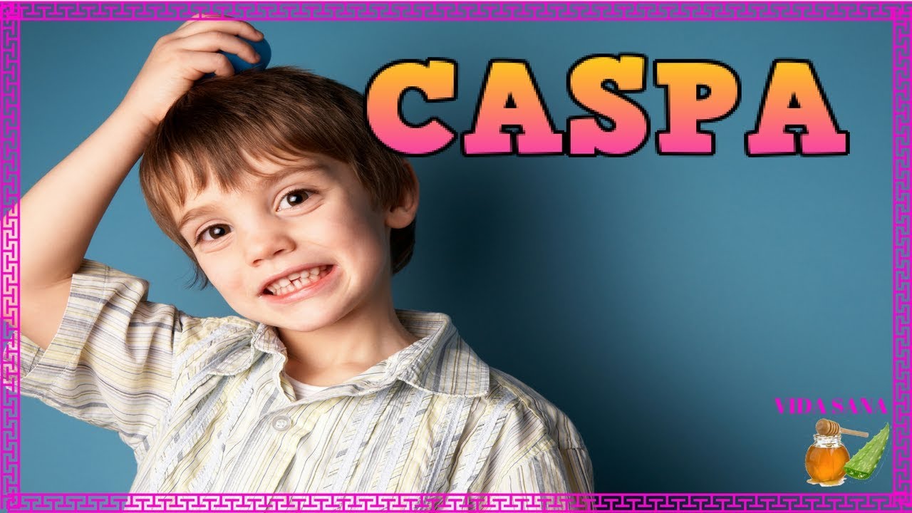 Remedios caseros para quitar la caspa muy rapido Remedios caseros para quitar la caspa muy rapido